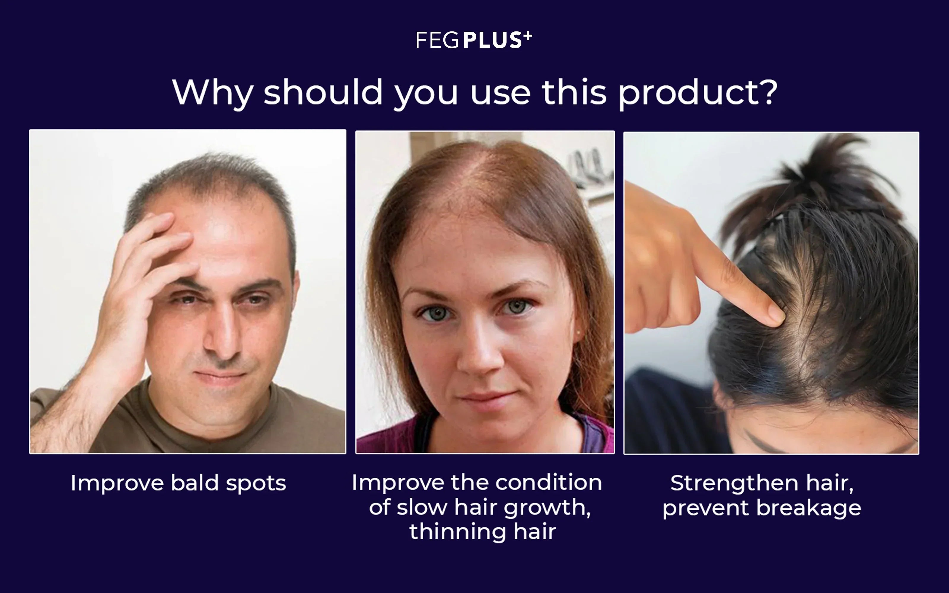 Feg Hair Growth Spray